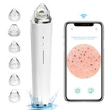 ZUN WiFi Visible Facial PoreCleanser with HD Camera Pimple AcneComedone Extractor Kit with 6 Suction 21863927