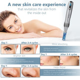 Electric Microneedle Derma Roller Pen with 15pcs Replacement Kit - Microneeding 0.25 mm Derma Roller 72702104