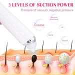 ZUN Vacuum Blackhead Remover with 6 Suction Heads, WIFI Visible Facial Pore Cleanser with HD Camera USB 51434358