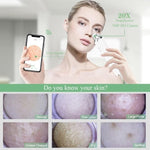 ZUN WiFi Visible Facial PoreCleanser with HD Camera Pimple AcneComedone Extractor Kit with 6 Suction 21863927
